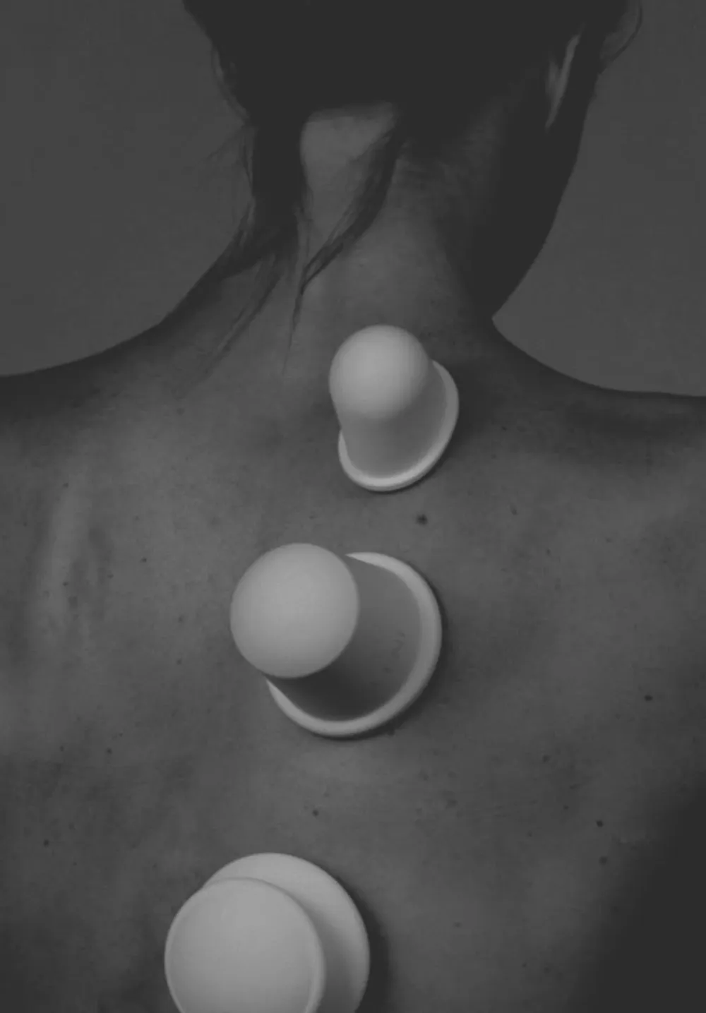 Cupping